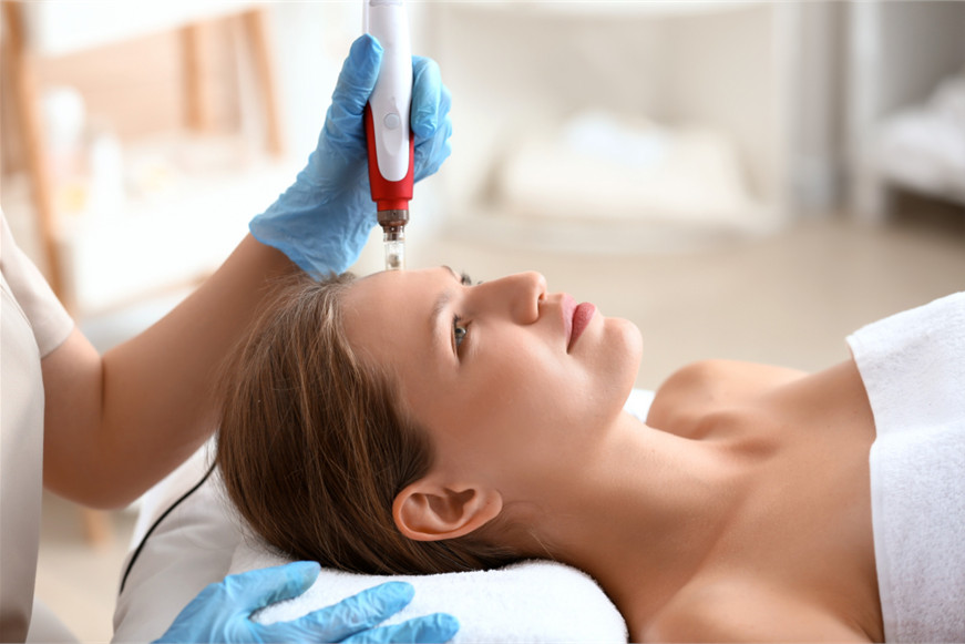 Microneedling