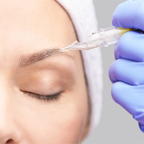Tattoo_Removal